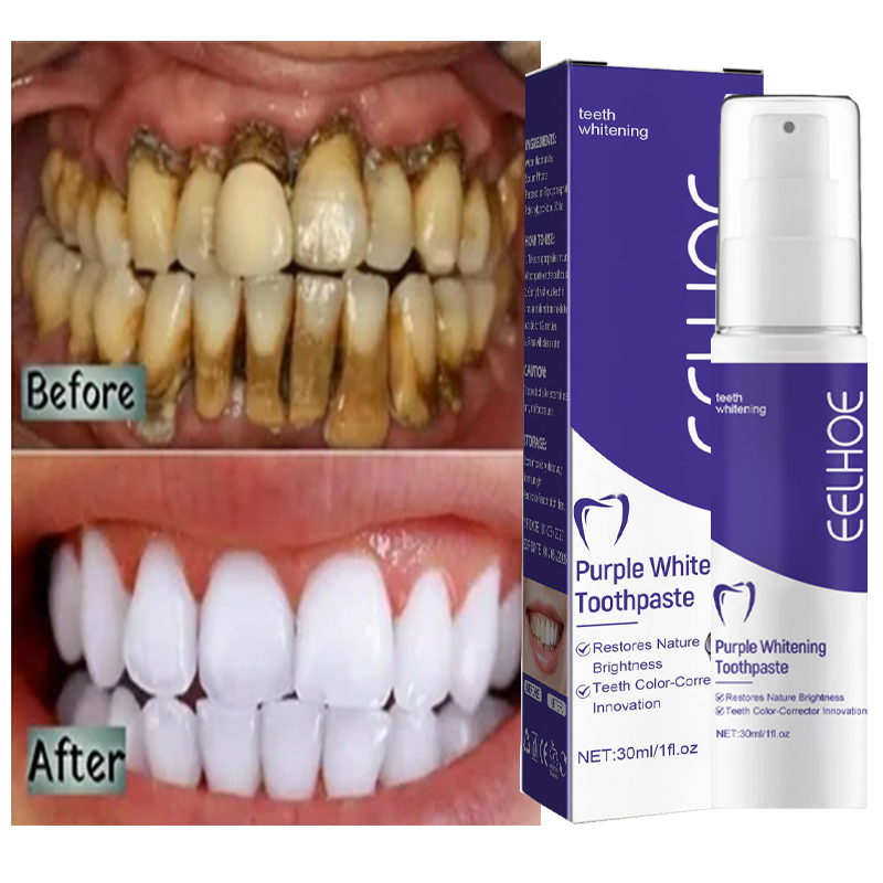 Teeth Whitening Korea - 치아 클렌징 미백 치약, 미백 젤