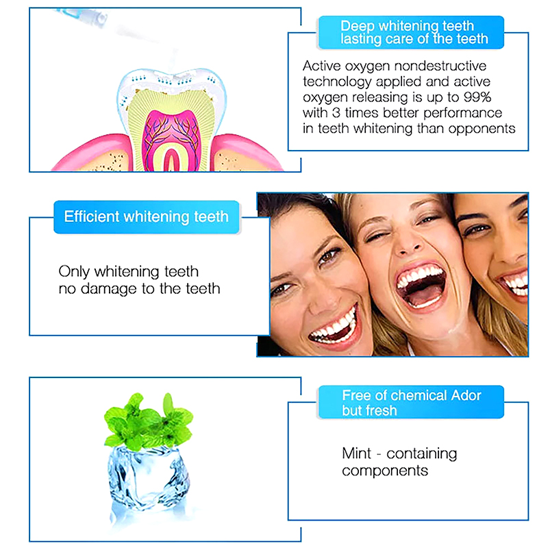 치아 미백 펜 전문 치아 미백 젤 커피, 담배 얼룩 제 - Teeth Whitening Bleaching Kit 리뷰 및 가격