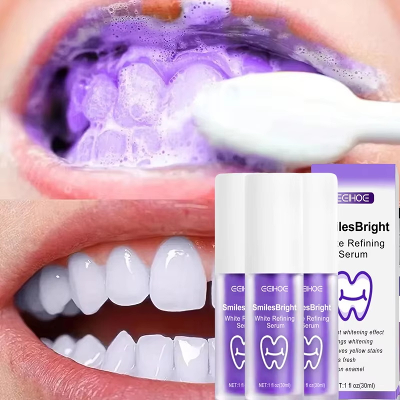치아 미백 치약 화이트닝 젤 화이트너 표백제 얼룩 제거 - Teeth Whitening Korea 리뷰 및 가격