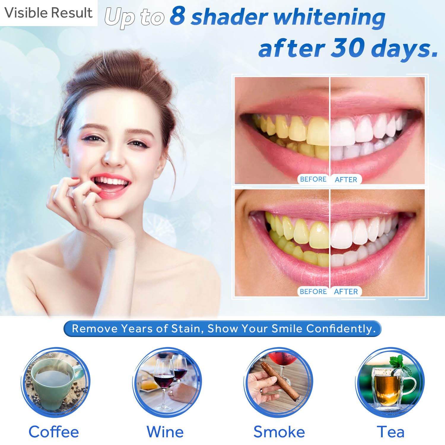 치아 미백 젤 리필 주사기 치아 미백 젤 인비스알라인  - Teeth Whitening Bleaching Kit 리뷰 및 가격
