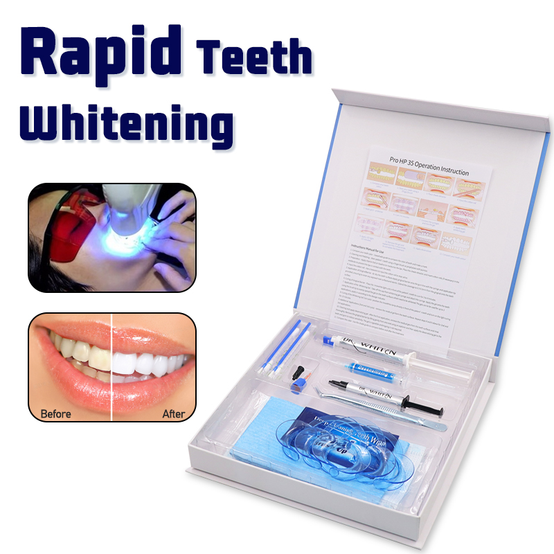 전문 치아 미백 키트 치과 표백 젤 35% 과산화수소  - Teeth Whitening Bleaching Kit 리뷰 및 가격