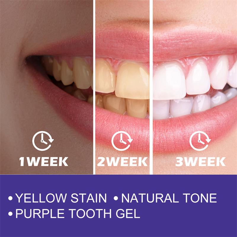 치아 클렌징 미백 치약, 미백 젤 표백제, 얼룩 제거, - Teeth Whitening Korea 리뷰 및 가격