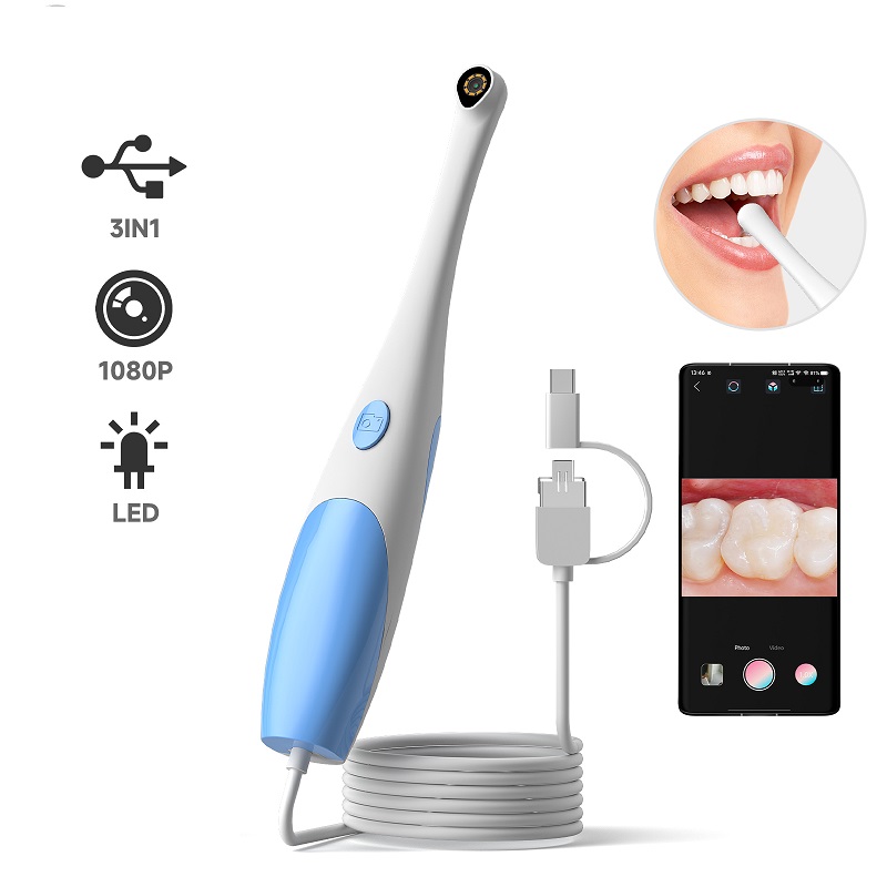 타입-C 구강 내시경 휴대용 비디오 구강 검사 카메라  - Teeth Whitening Video 리뷰 및 가격