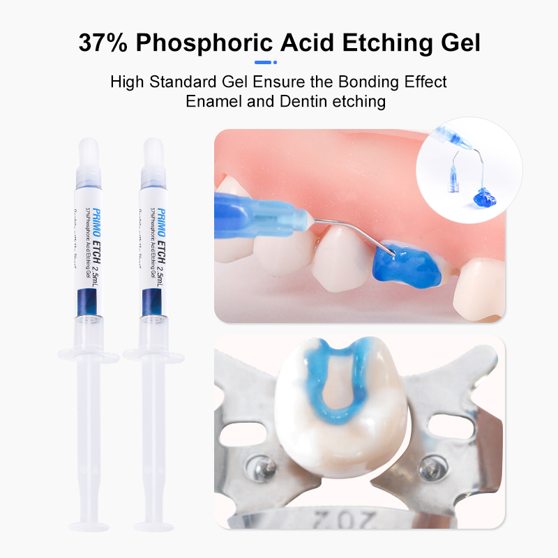 치아 보석 세트 접착제 키트 UV 경화 빛 치과 교정  - Uv Whitening Kit 리뷰 및 가격